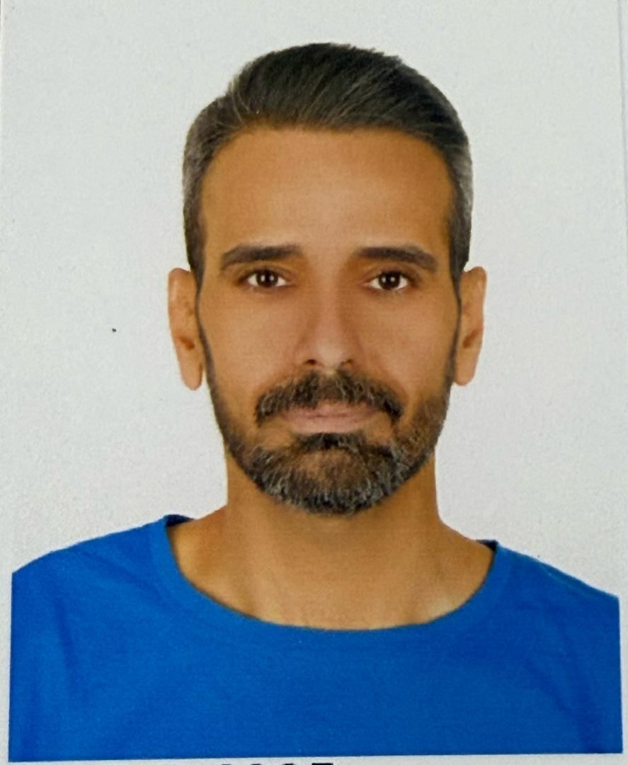 کاشت مو قبل از درمان - نمونه ۲ کلینیک شیوا کیانی